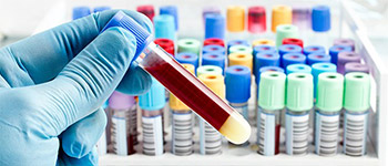 Phlebotomy - Careers - Courses - Westside Extension